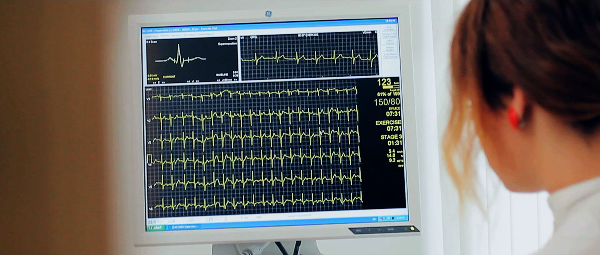 Test opterećenja Poliklinika Lacić